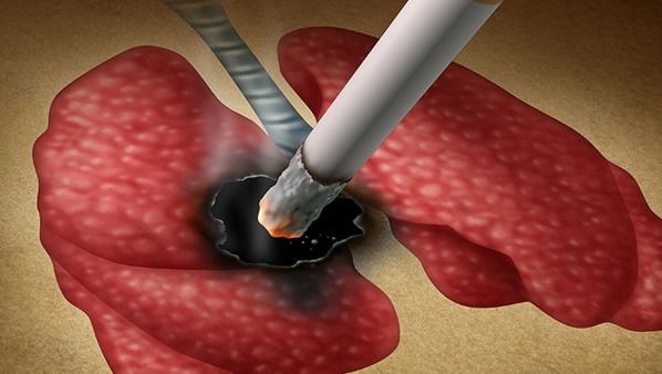 1599813027136875.jpeg 555555555.jpeg