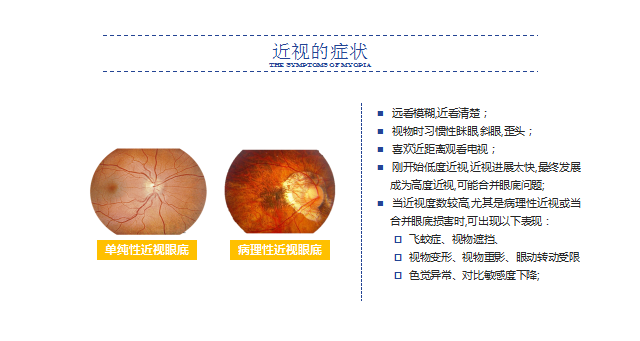 1622019991131315.png 3.近视的症状.png